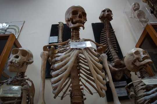 Azərbaycanda Anatomiya Muzeyi yaradıldı