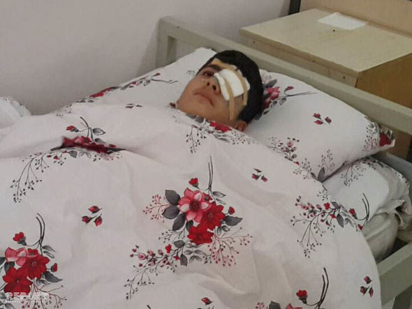 Abşeronda məktəbli gözündən güllə yarası alıb – FOTO
