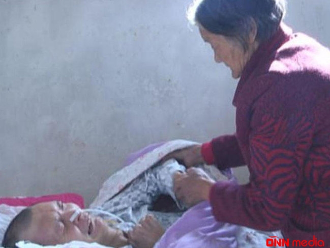12 il sonra komadan ayılan kişi anasını yanında görüb hönkürdü - FOTO