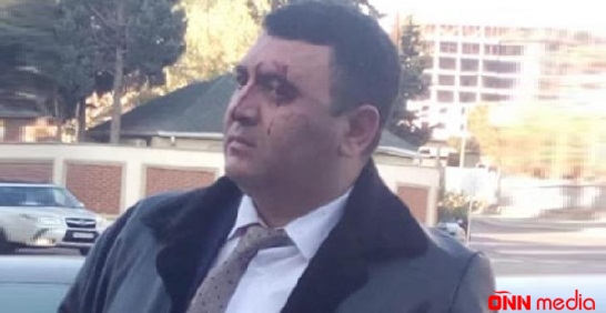 Döyülən direktor iş vaxtı niyə başqa yerdə olub?- AÇIQLAMA