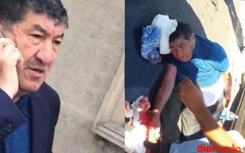 Ağır qəzaya düşən iş adamı Hacı Mazandan YENİ XƏBƏR