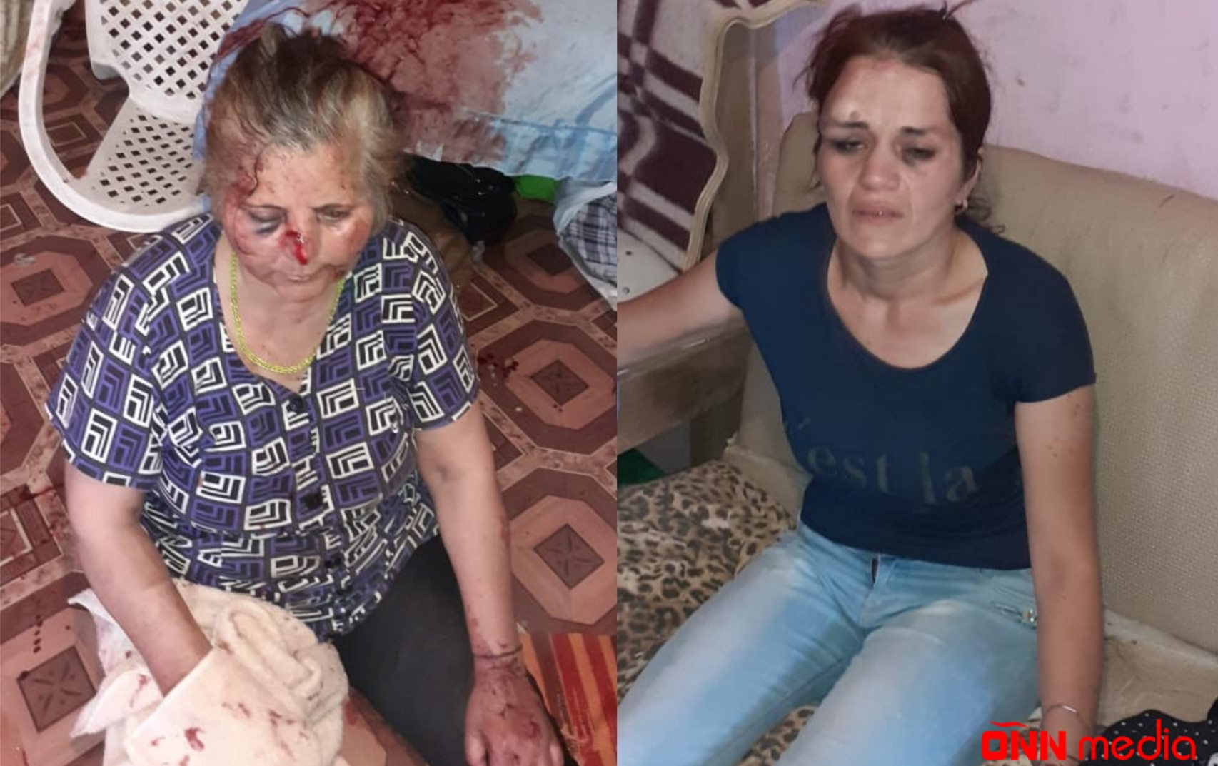 Kürəkən qaynanasını döydü və... - ŞOK OLAY