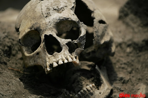 Bakıda uşaq düşərgəsində ölüm — Bir ayağı qısa qadın skeletinin sirri - TƏFƏRRÜAT