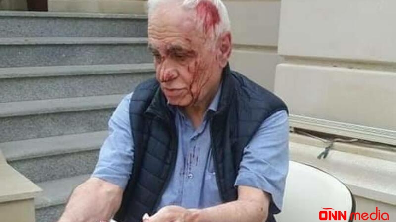 Bakıda ŞOK OLAY - Sabiq nazirin başını yardılar