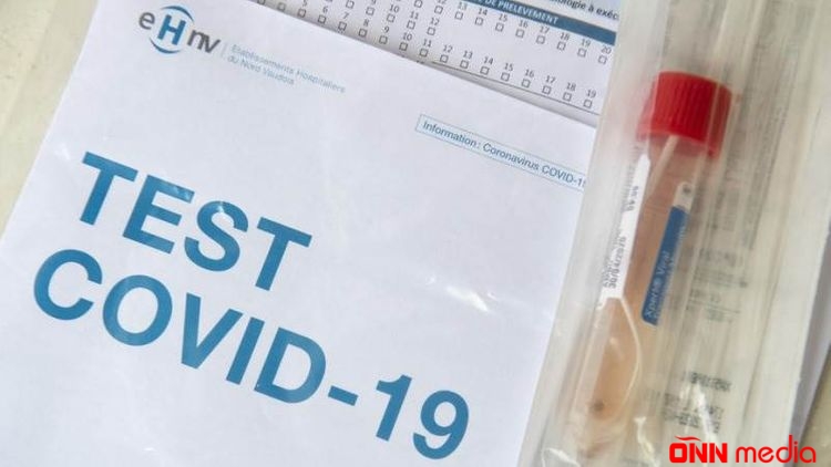 COVID-19 testinin cavabı gecikən şəxslər nə etməlidir? - RƏSMİ AÇIQLAMA