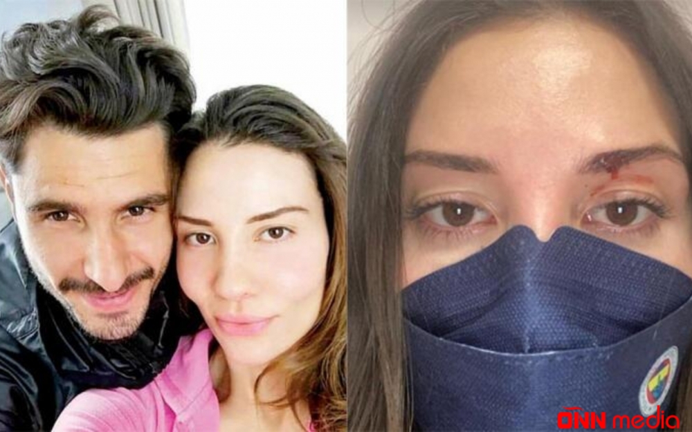 Boşanmaqdan imtina etmişdi, şiddətə məruz qaldı
