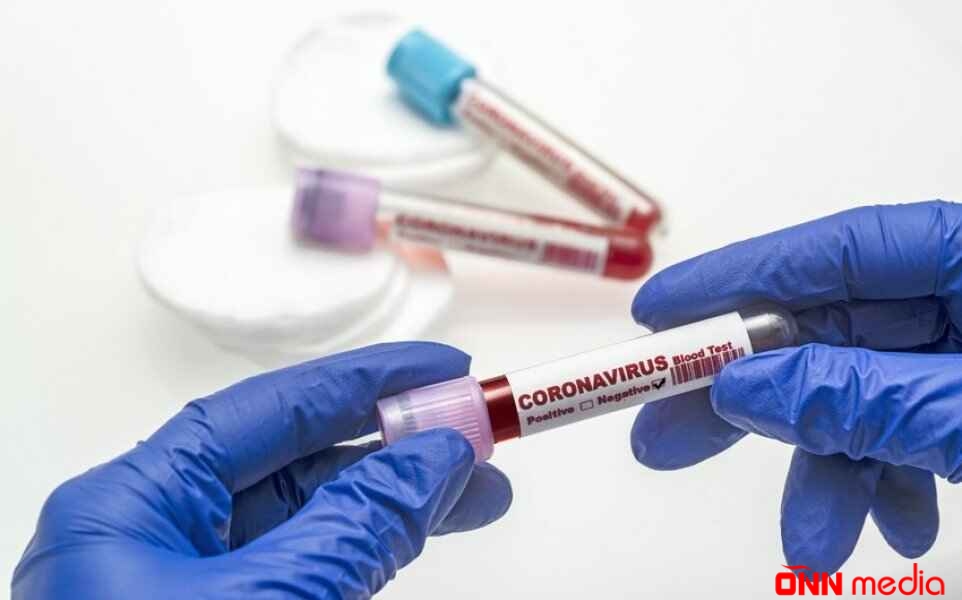 Günün koronavirus statistikası açıqlandı