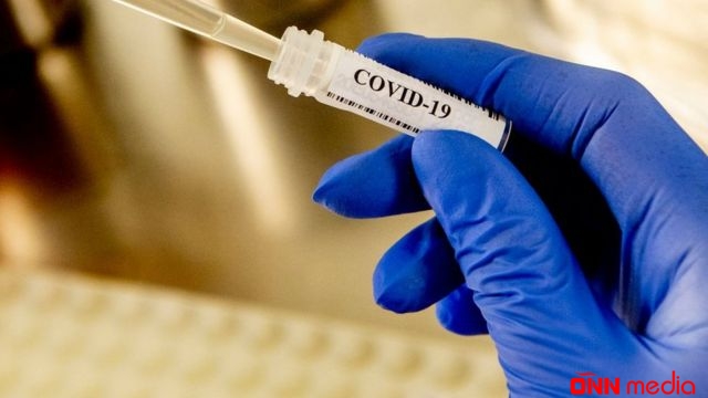 Günün koronavirus statistikası açıqlandı