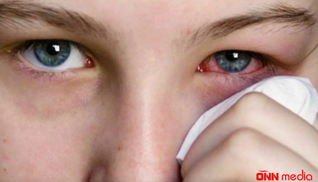 Koronavirus bu formada yenidən qayıtdı - SİMPTOMLARI FƏRQLİDİR