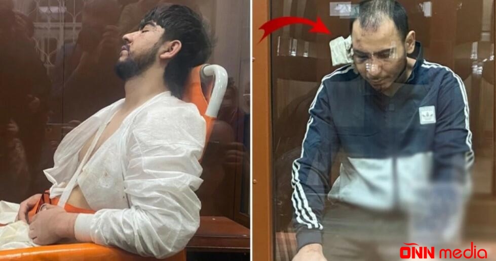 Terrorçuların qulaqları niyə kəsilib?