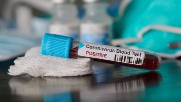 Kiyevdən qayıdan 29 nəfərdə koronavirus aşkarlandı