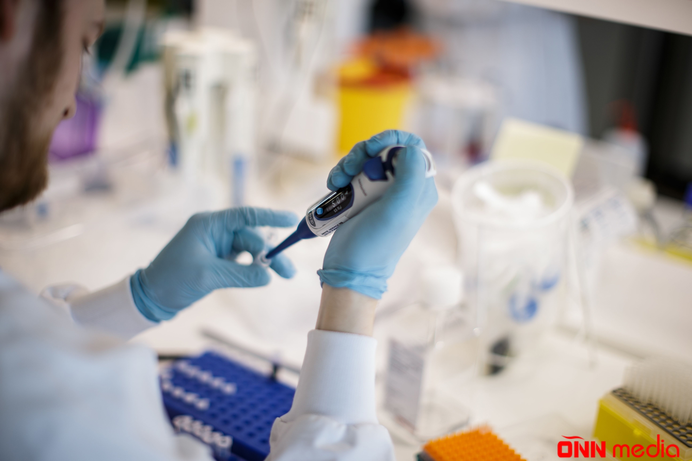 Çinli professordan QORXUNC proqnoz: “Koronavirusa qarşı…”