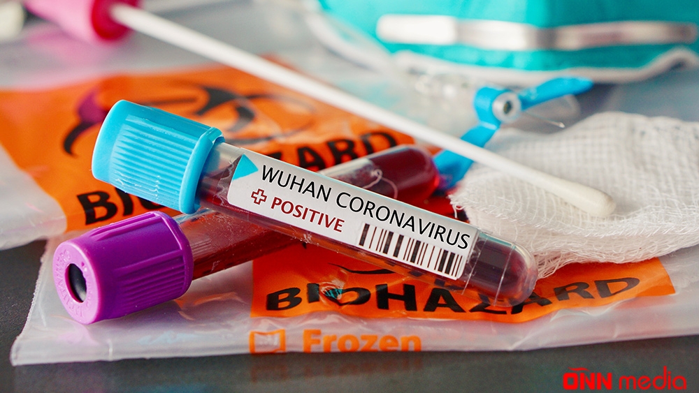 Azərbaycanda daha 4170 nəfər koronavirusa yoluxdu
