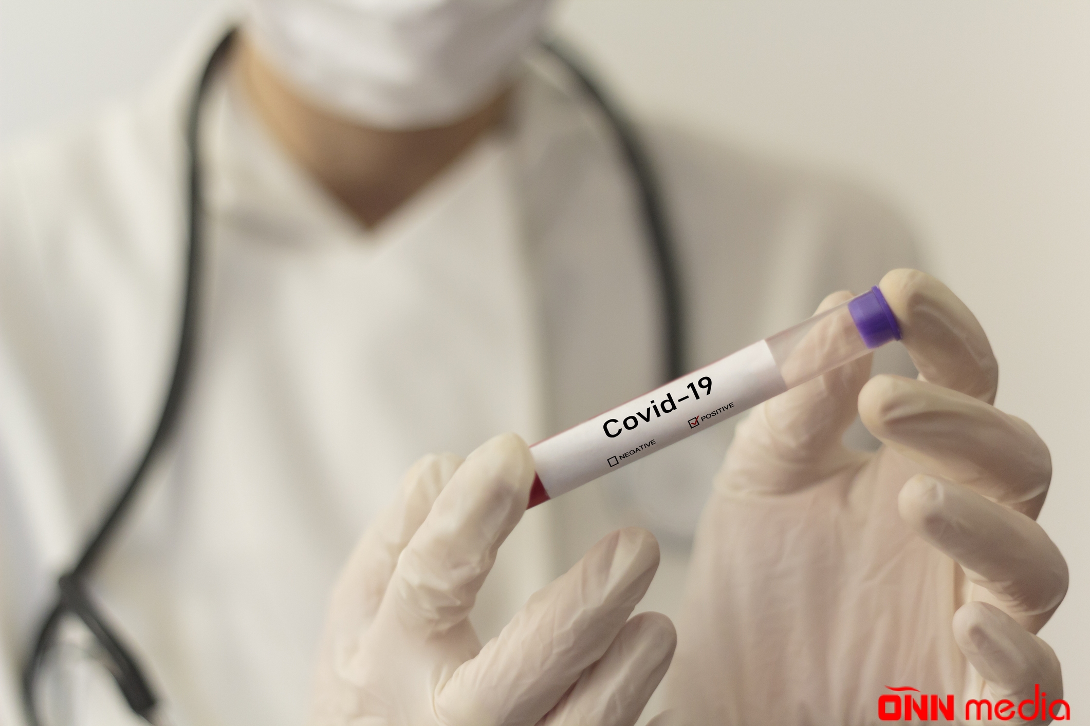 Azərbaycanda koronavirusa yoluxma sayı artdı – 37 nəfər öldü