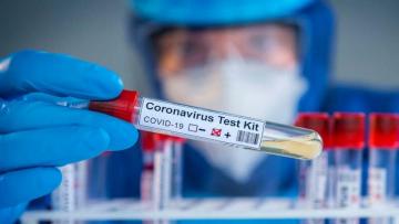 Azərbaycanda koronavirusa yoluxma sayı azaldı, 29 nəfər öldü